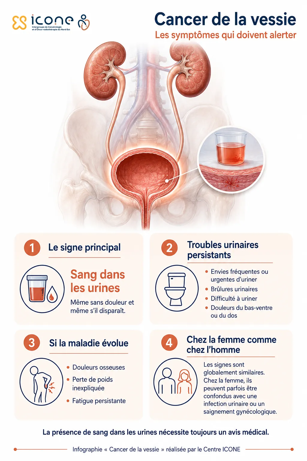 infographie cancer vessie symptomes
