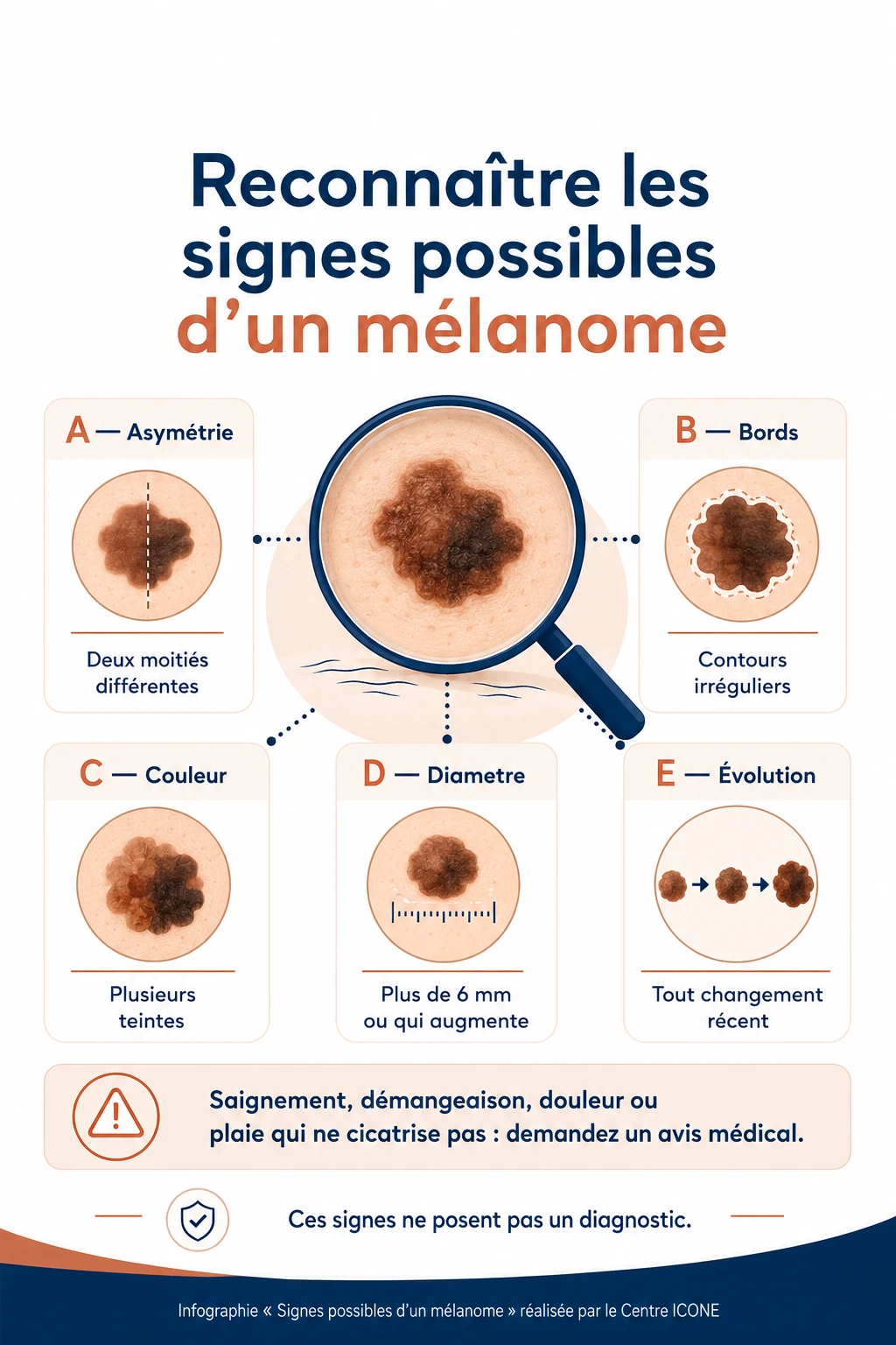 signe symptome melanome